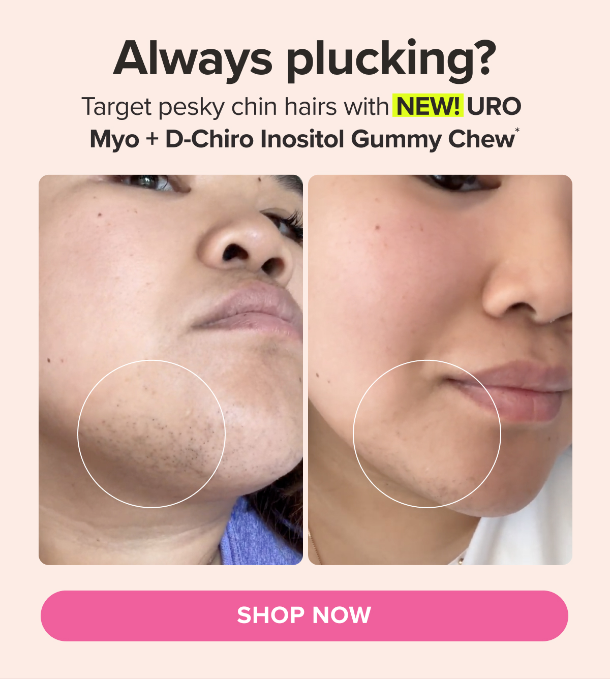 Always plucking? Target pesky chin hairs with NEW! URO Myo + D-Chiro Inositol Gummy Chew* SHOP NOW