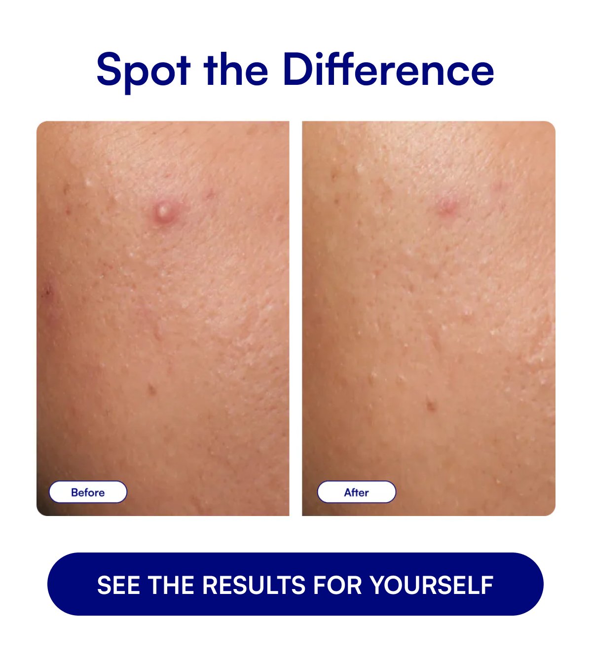 Spot the Difference SEE THE RESULTS FOR YOURSELF