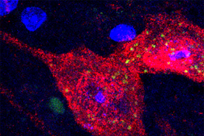 A microscopic view of misshapen proteins.