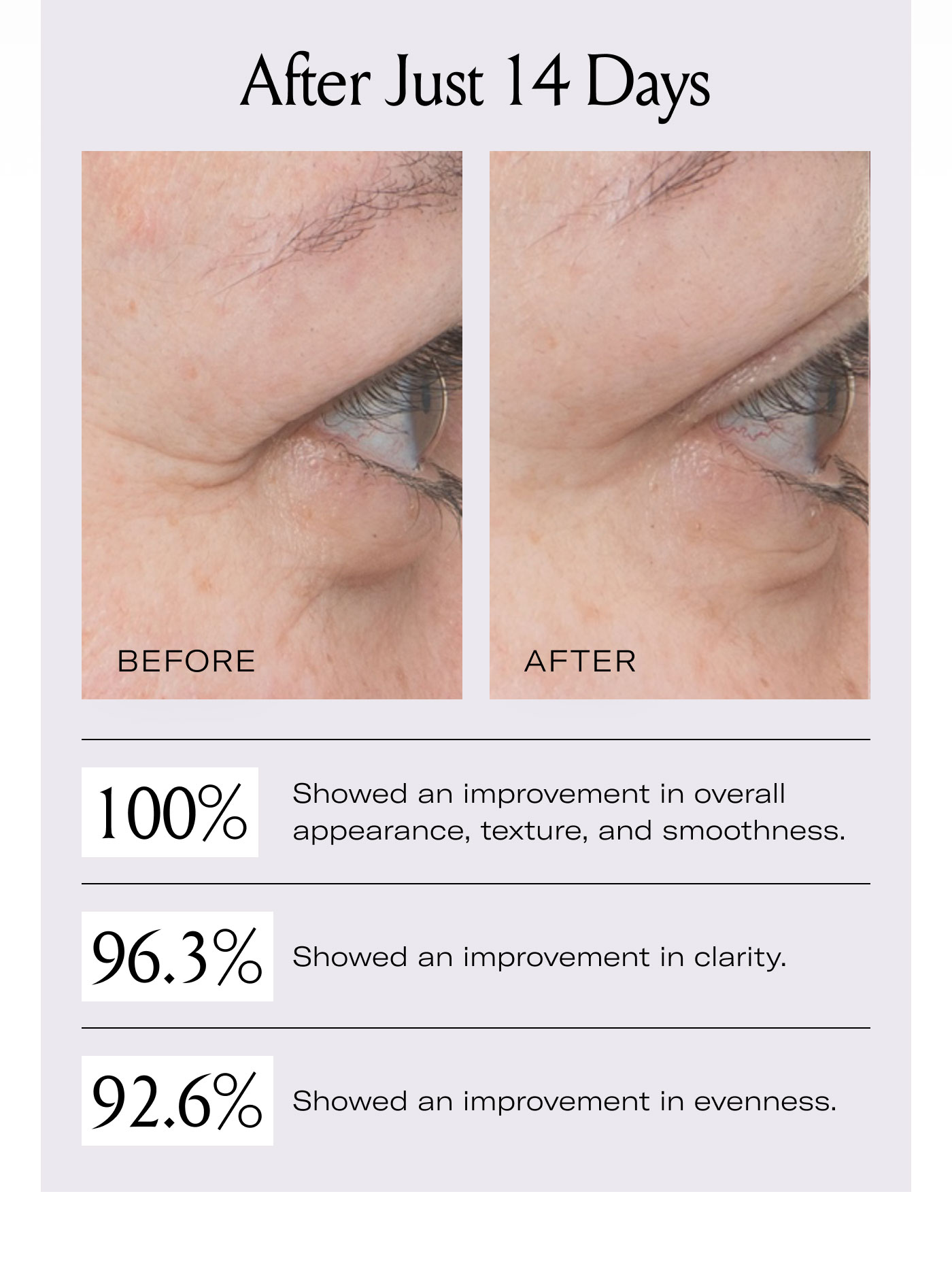 After Just 14 Days 100% Showed an improvement in overall appearance, texture, and smoothness.  96.3% Showed an improvement in clarity.  92.6% Showed an improvement in evenness.