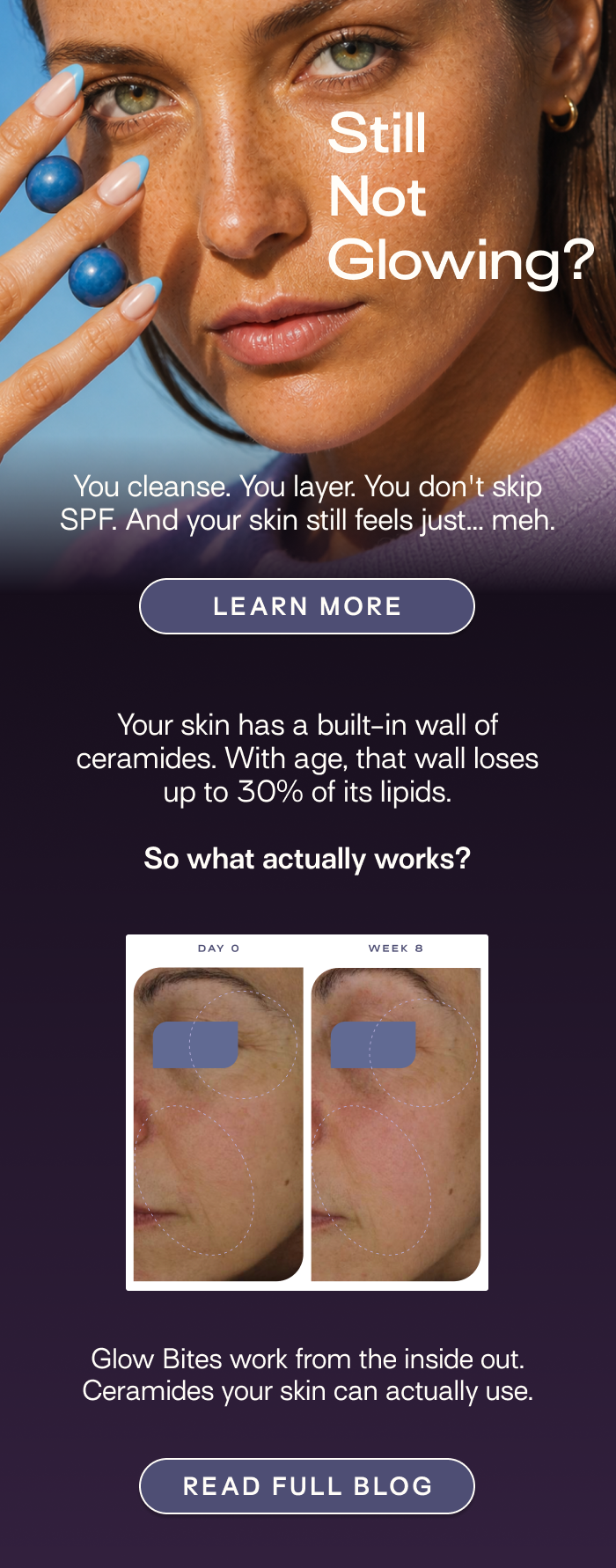 Why Your Moisturizer Is Not Enough (And What Is) - LEARN MORE