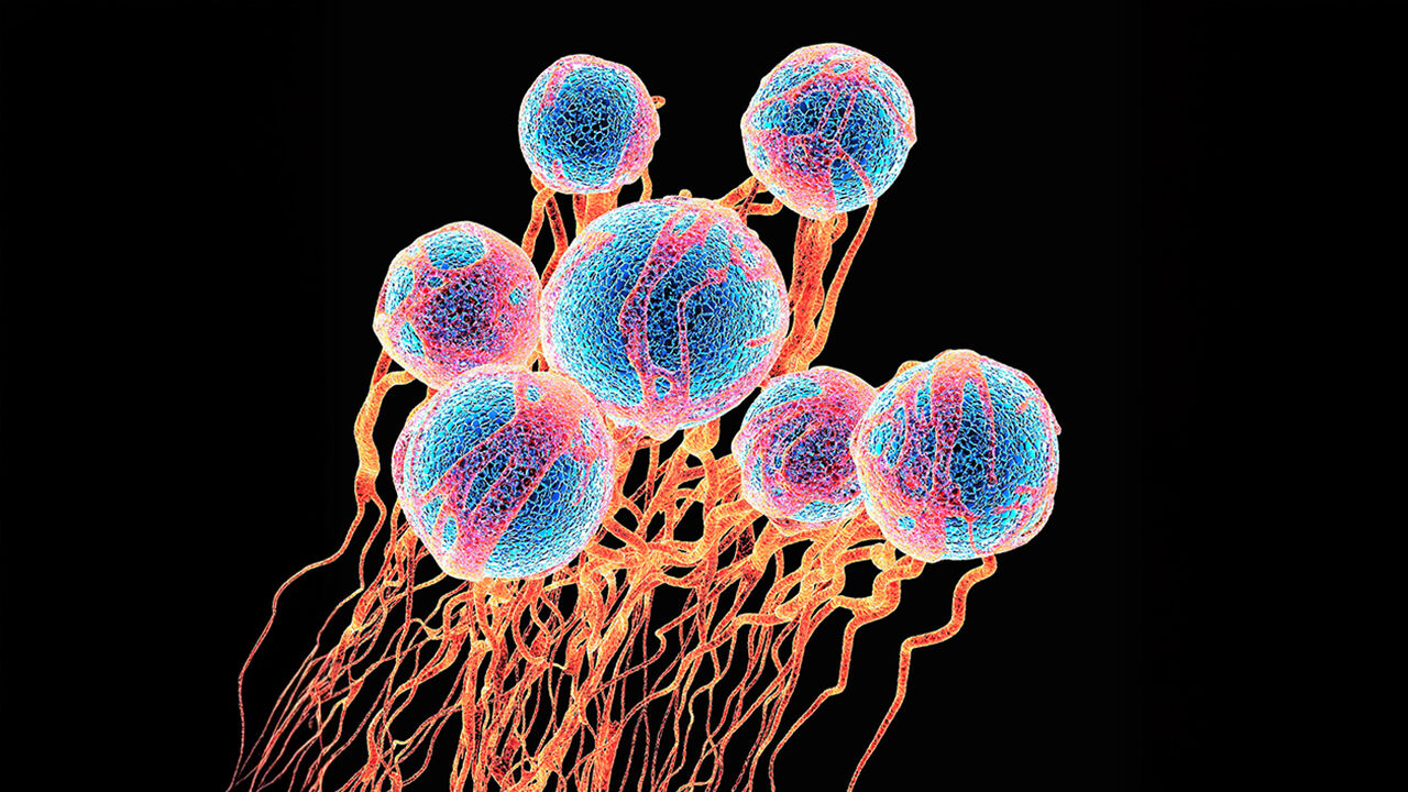 cancer cells, showing the blood vessel formation providing the cells with oxygens and nutrients.