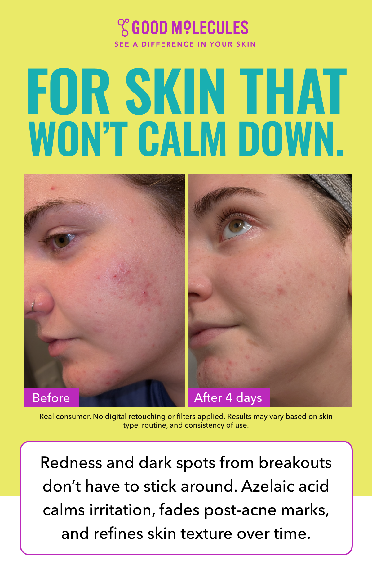 For skin that won't calm down.