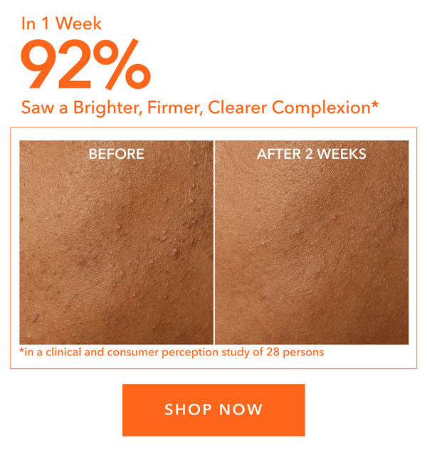 Alpha Beta Universal Daily Peel Results
