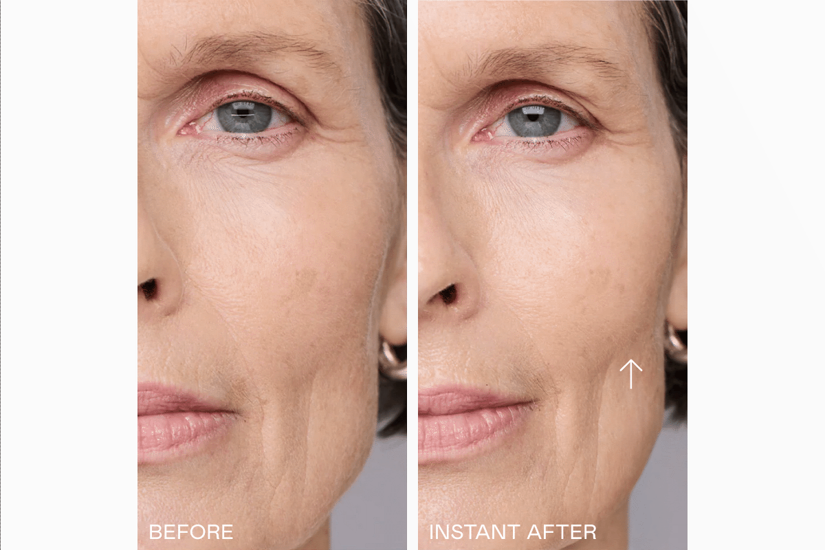 Before & After