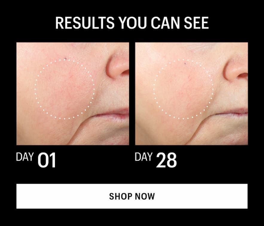 RESULTS YOU CAN SEE - Shop Now