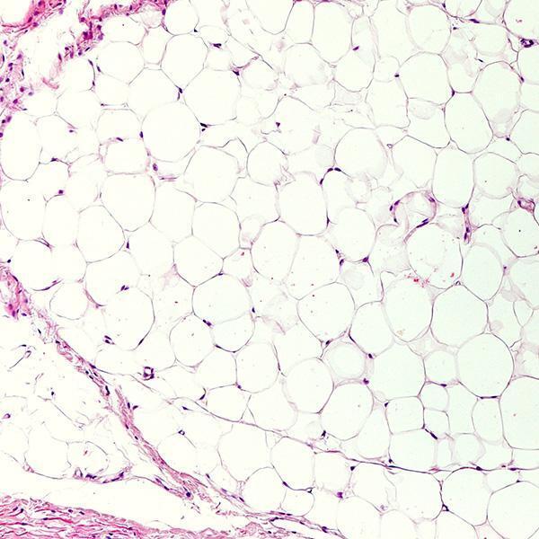 Adipose cells photographed under a microscope