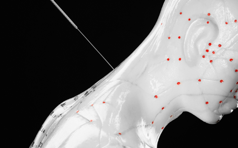 During acupuncture, fine needles are placed at targeted points on the body. Researchers are now uncovering how this localized stimulation can ripple through connective tissue, the nervous system, and the brain to ease pain.&nbsp;