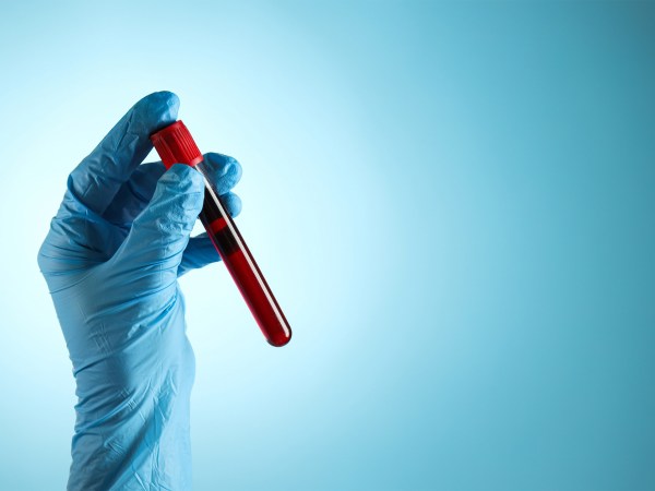 Blood in test tube.