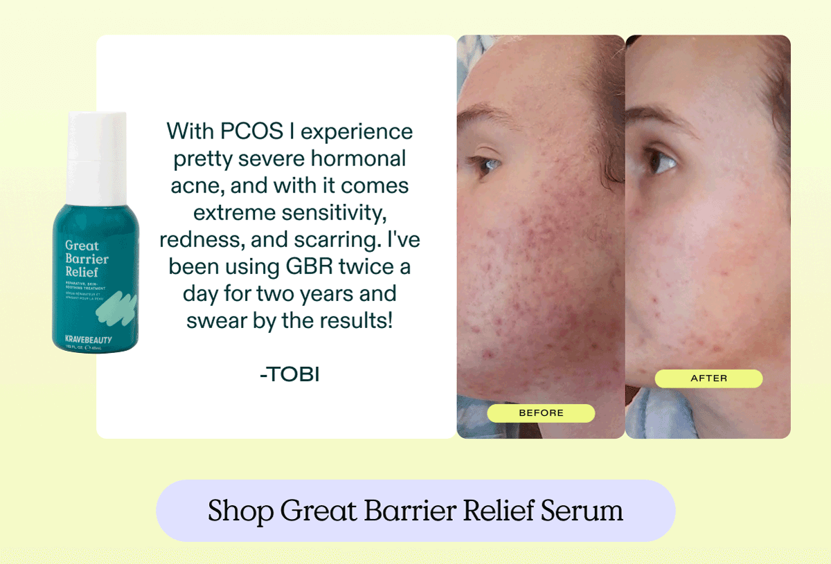 "With PCOS I experience pretty severe hormonal acne, and with it comes extreme sensitivity, redness, and scarring. I've been using GBR twice a day for two years and swear by the results!" - Tobi. Shop Great Barrier Relief Serum