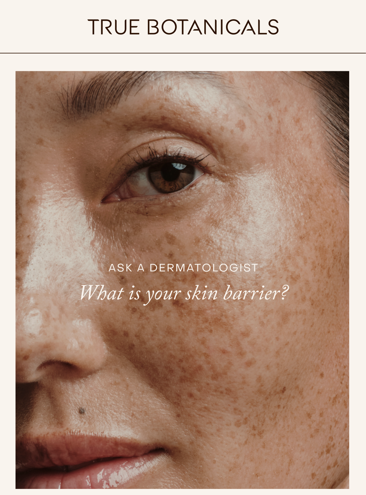 What is your skin barrier?