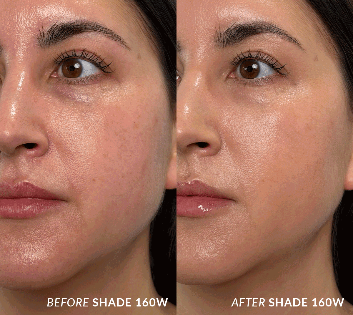Before & after Skin Base 