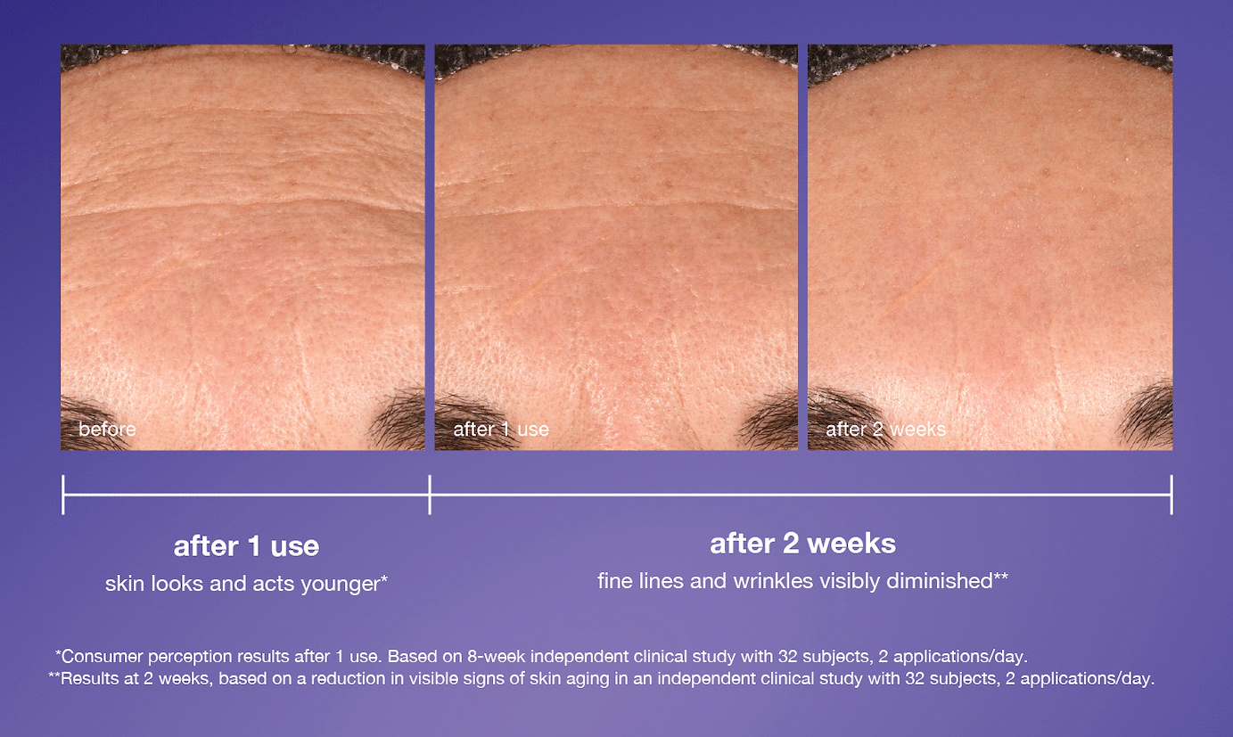 after 1 use | skin looks and acts younger* | after 2 weeks | fine lines and wrinkles visibly diminishes** | *consumer preception after 1 use. based on 8-weeks independent clinical study with 32 subjects, 2 applications/day | **results at 2 weeks based on a reduction of visible signs of skin aging in an independent clinical study with 32 subjects, 2 applications/day