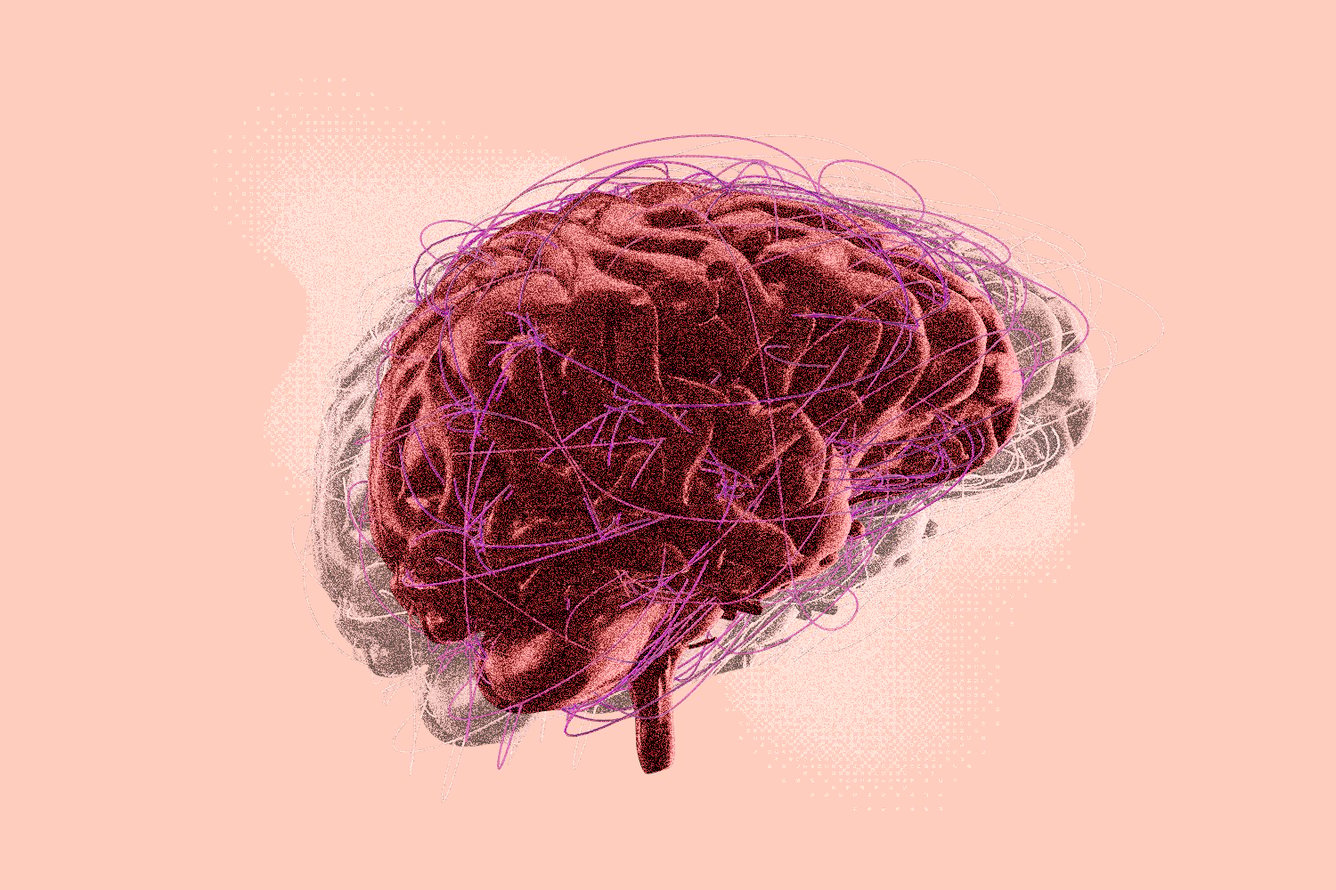 An AI model brain