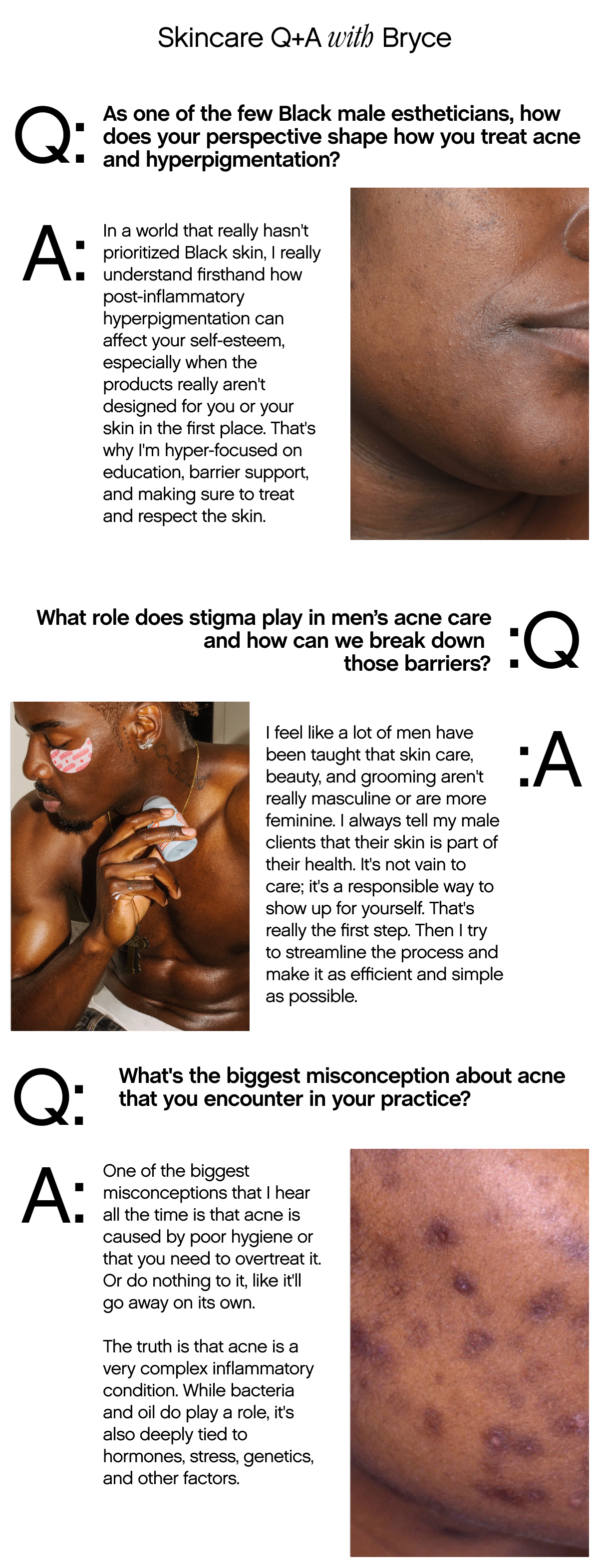 Skincare Q+A with Bryce