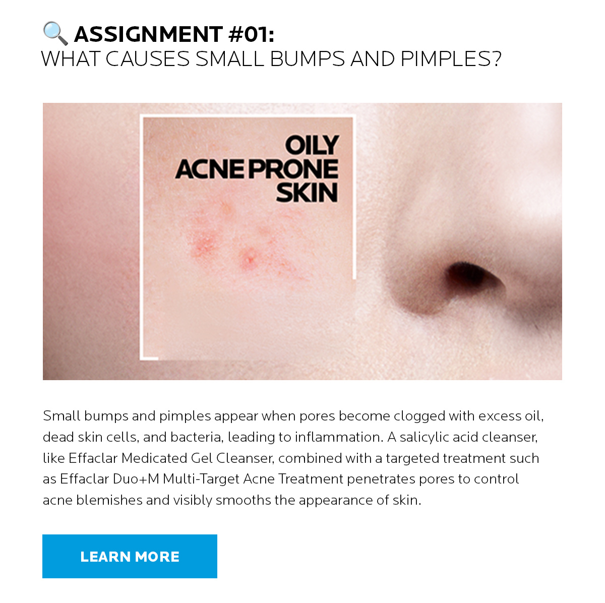 What causes small bumps and pimples